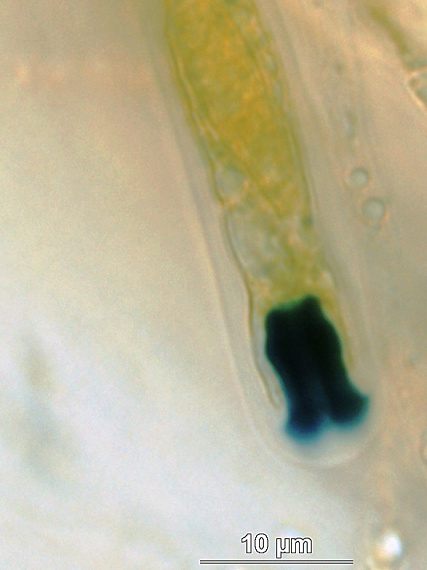 rozelínia vlnatá Rosellinia corticium (Schwein.) Sacc.