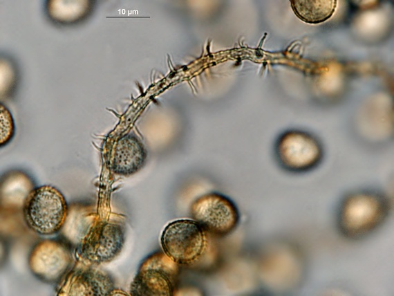 slizovka - Rozvorka žlutovýtrusá Perichaena chrysosperma (Curr.) Lister