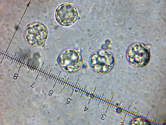 muchotrávka chrastavá Amanita ceciliae (Berk. & Broome) Bas