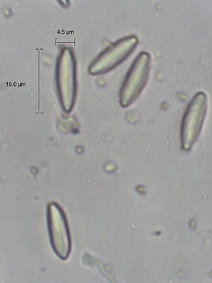 lúpavka hrubá Hysterangium crassum (Tul. & C. Tul.) E. Fisch.