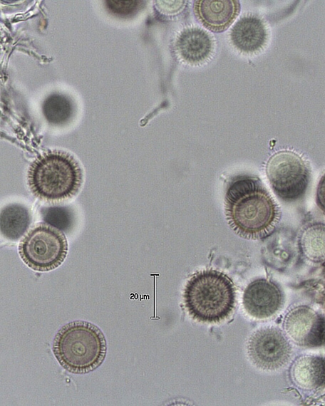 srnka obyčajná Elaphomyces granulatus Fr.