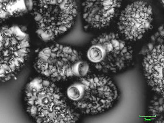 hnojník kostrbatý Coprinopsis echinospora (Buller) Redhead, Vilgalys & Moncalvo