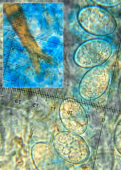 štítovnička čiernochlpatá Scutellinia nigrohirtula (Svrček) Le Gal