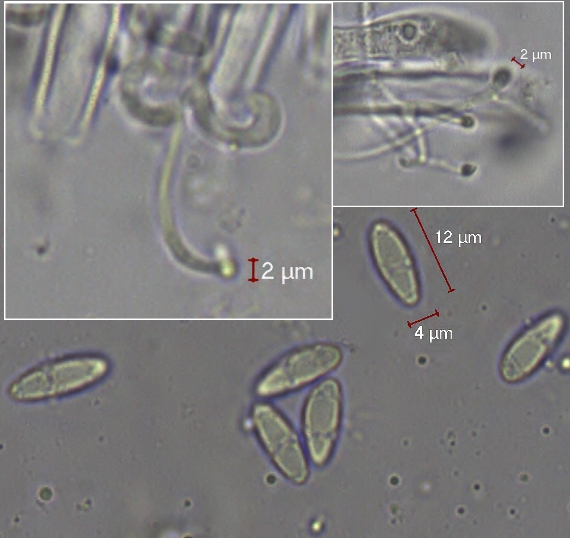 šošovka žltá Podophacidium xanthomelum (Pers.) Kavina