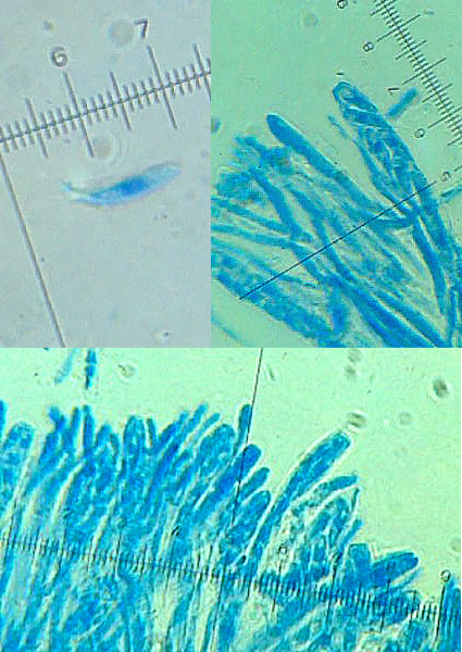 ascomycetes  Ascomycetes