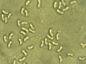 černorosol chrupavčitý - Tmavorôsolovec brezový Exidia cartilaginea  S. Lundell & Neuhoff