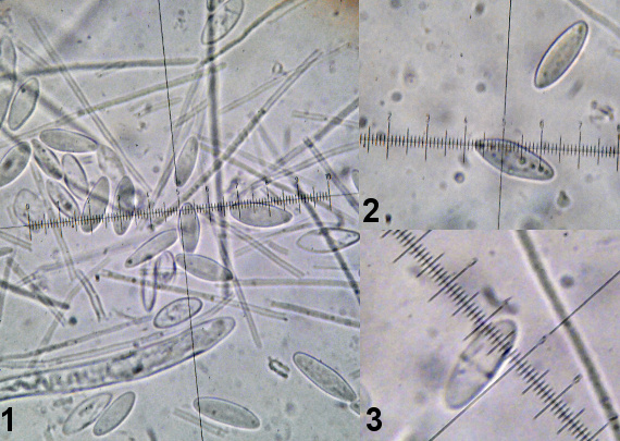 vlnuška neškodná Lachnellula occidentalis (G.G. Hahn & Ayers) Dharne