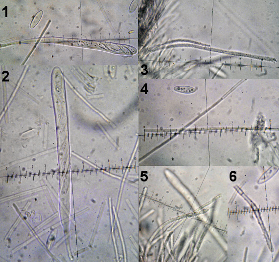 vlnuška neškodná Lachnellula occidentalis (G.G. Hahn & Ayers) Dharne