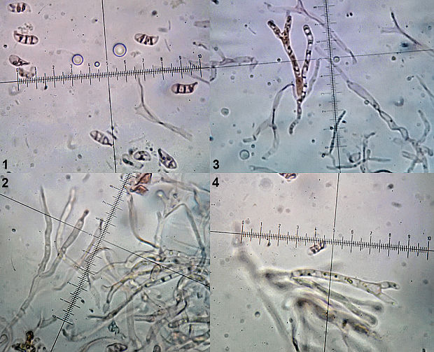 slzovec rôsolovitý Dacrymyces stillatus Nees