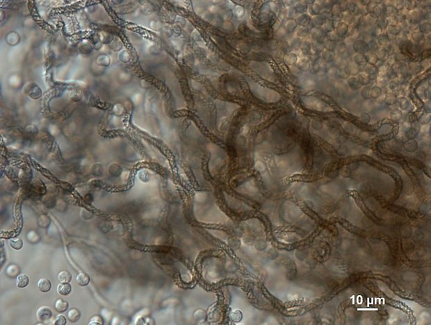 vlasovníčka Hemitrichia imperialis (G. Lister) Q. Wang & Yu Li