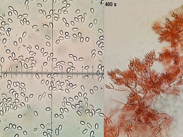 Hyphomyces sp.