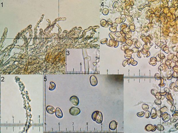 Episphaeria fraxinicola (Berk. & Broome) Donk