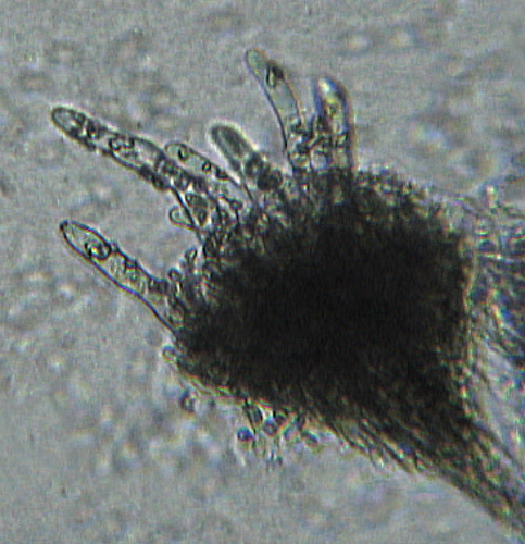 kožovka štetinatá Hyphoderma setigerum (Fr.) Donk
