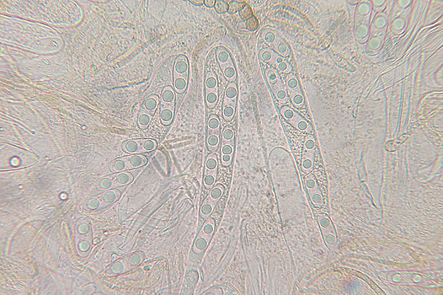 kvapka Octospora musci-muralis var. neglecta ? (Dennis & Itzerott) Benkert