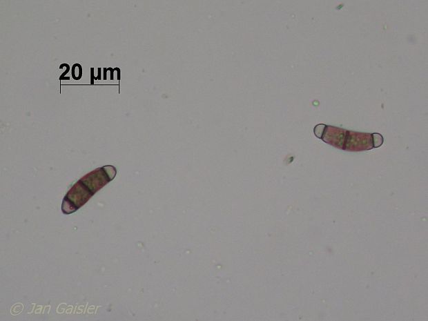 Chaetosphaerella fusca (Fuckel) E. Müll. & C. Booth