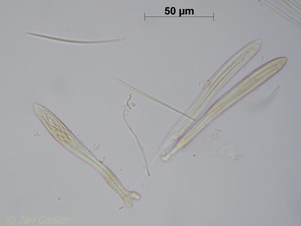 čerň javorová Rhytisma acerinum (Pers.) Fr.