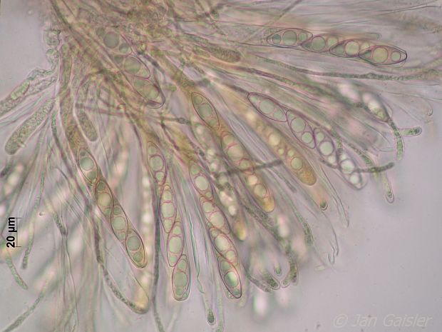 kvapka žltkavá štvorvýtrusná Octospora axillaris var. tetraspora