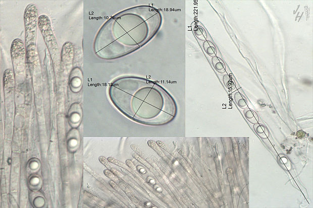 kvapka Octospora rubens (Boud.) M.M. Moser