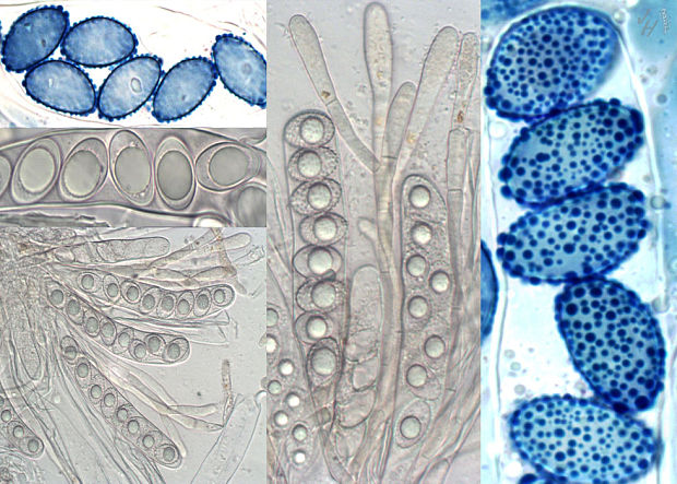 kvapka Octospora orthotrichi (Cooke & Ellis) K.B. Khare & V.P. Tewari