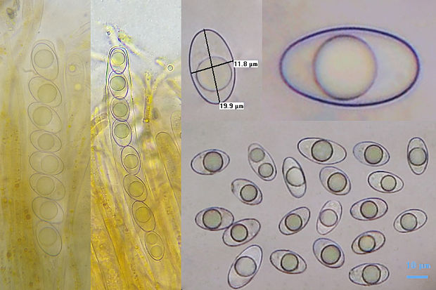 kvapka Octospora gyalectoides Svrček et Kubička