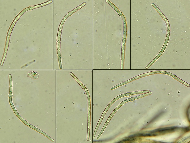 Nodulosphaeria pontica (Petr.) L. Holm