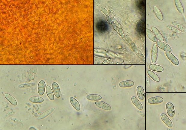 hlivka Neonectria ditissima (Tul. & C. Tul.) Samuels & Rossman
