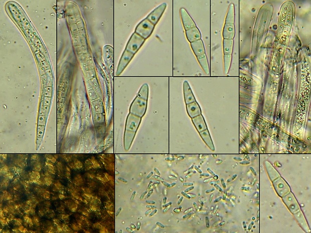 drobnosférka Paraleptosphaeria macrospora (Thüm.) Gruyter, Aveskamp & Verkley