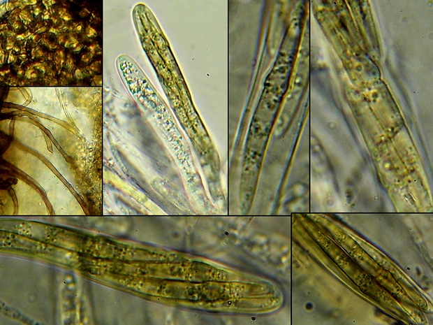 - Nodulosphaeria aquilana (D. Sacc.) L. Holm