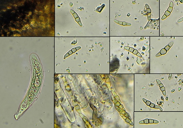 drobnosférka Leptosphaeria pini (Cruchet) E. Müll.