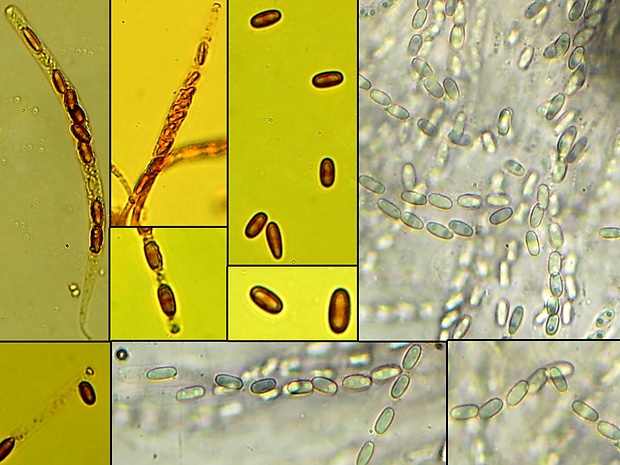 Phomatospora berkeleyi Sacc.