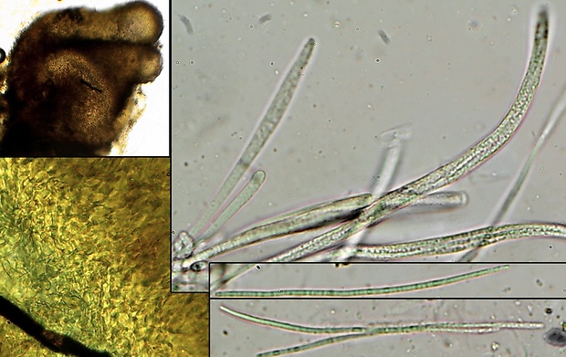 Neobarya parasitica (Fuckel) Lowen