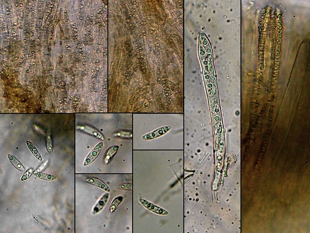 čiašočka Hymenoscyphus calyculus (Fr.) W. Phillips